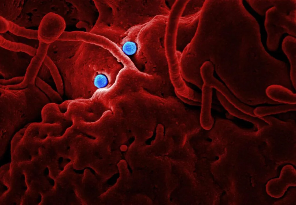 Herpes Simplex virus