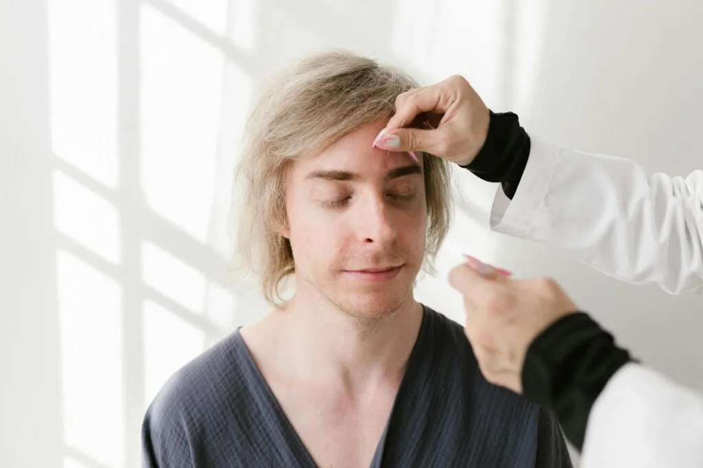 man getting an acupuncture